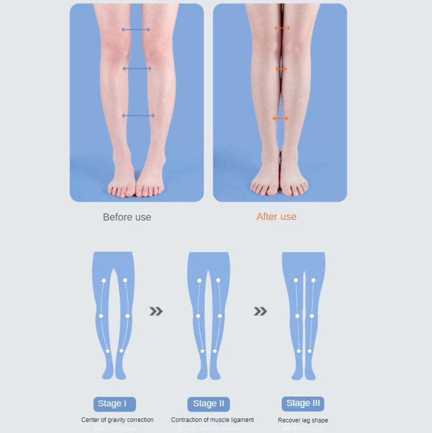 Ортопедические стельки из иску – обзор и цена Men Shoes Type